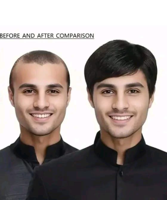 Mans skin base article