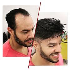 USA Fine Mono Hair Replacement System Hair Unit